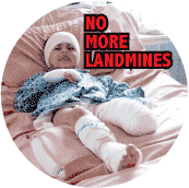 No More Landmines - Landmine Victim ANTI-WAR POSTER